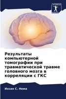 Результаты компьютерной томографии при травматической травме головного мозга в корреляции с ГКС 6206067491 Book Cover
