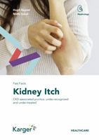 Fast Facts: Kidney Itch 3318070742 Book Cover