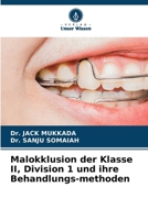 Malokklusion der Klasse II, Division 1 und ihre Behandlungs-methoden (German Edition) 6630171861 Book Cover
