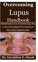 Overcoming Lupus Handbook: Detailed Guide on How to Overcome Lupus, How to Carry Out Its diagnosis & Its Treatment as Well as Other Reliable Remedies B08F6Y52P1 Book Cover