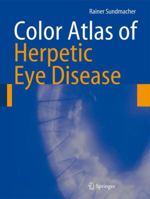 Color Atlas of Herpetic Eye Disease: A Practical Guide to Clinical Management 3540694625 Book Cover