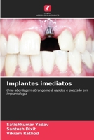 Implantes imediatos (Portuguese Edition) 6208060443 Book Cover