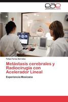 Metastasis Cerebrales y Radiocirugia Con Acelerador Lineal 3659026832 Book Cover