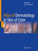Atlas of Dermatology in Skin of Color 3032210569 Book Cover