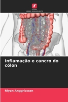 Inflamação e cancro do cólon 6206620425 Book Cover