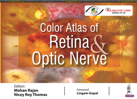 Color Atlas of Retina and Optic Nerve 9354651135 Book Cover