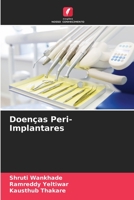 Doenças Peri-Implantares 6205759802 Book Cover