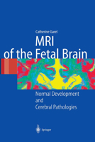 MRI of the Fetal Brain: Normal Development and Cerebral Pathologies 3540407472 Book Cover
