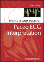 The Nuts and bolts of Paced ECG Interpretation 1405184043 Book Cover