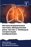 Автоматизированная система обнаружения рака легких с помощью сегментации изображения 6205966727 Book Cover