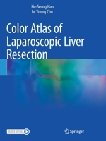 Color Atlas of Laparoscopic Liver Resection 9811615489 Book Cover