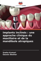 Implants inclinés: une approche clinique du maxillaire et de la mandibule atropiques (French Edition) 6206903737 Book Cover