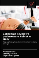 Zaka&#380;enia szyjkowo-pochwowe u kobiet w ci&#261;&#380;y 6203485837 Book Cover