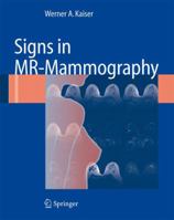 Signs in MR-Mammography 3642092330 Book Cover