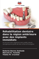 Réhabilitation dentaire dans la région antérieure avec des implants immédiats (French Edition) 6207546857 Book Cover