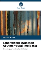 Schnittstelle zwischen Abutment und Implantat (German Edition) 6207762770 Book Cover