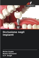 Occlusione negli impianti (Italian Edition) 6208934656 Book Cover