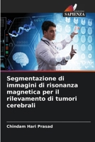 Segmentazione di immagini di risonanza magnetica per il rilevamento di tumori cerebrali (Italian Edition) 6206951243 Book Cover