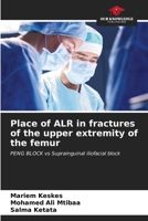 Place of ALR in fractures of the upper extremity of the femur 6206520587 Book Cover