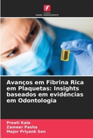 Avanços em Fibrina Rica em Plaquetas: Insights baseados em evidências em Odontologia (Portuguese Edition) 6209052630 Book Cover