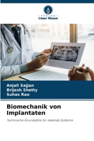 Biomechanik von Implantaten: Technische Grundsätze für lebende Systeme 6206137740 Book Cover