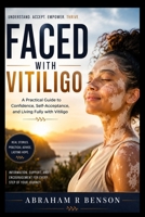 Faced with vitiligo: A Practical Guide to Confidence, Self-Acceptance, and Living Fully with Vitiligo B0H8WX3XW8 Book Cover