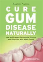Cure Gum Disease Naturally: Heal and Prevent Periodontal Disease and Gingivitis with Whole Foods 0982021364 Book Cover