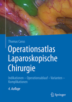 Operationsatlas Laparoskopische Chirurgie: Indikationen - Operationsablauf - Varianten - Komplikationen 3642312454 Book Cover