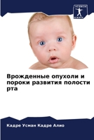 Врожденные опухоли и пороки развития полости рта 6206050815 Book Cover