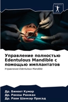 Управление полностью Edentulous Mand 6203662453 Book Cover