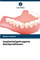 Implantatgetragene Deckprothesen 6206243087 Book Cover