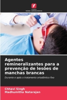 Agentes remineralizantes para a prevenção de lesões de manchas brancas: Durante e após o tratamento ortodôntico fixo (Portuguese Edition) 6207388976 Book Cover
