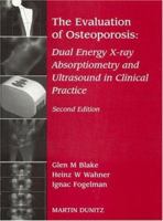 The Evaluation of Osteoporosis: Dual Energy X-ray Absorptiometry and Ultrasound in Clinical Practice B01CMYB8K2 Book Cover