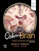 Osborn's Brain: Imaging, Pathology, and Anatomy 0443109370 Book Cover
