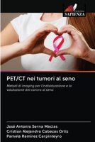 PET/CT nei tumori al seno 6203113891 Book Cover