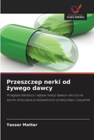 Przeszczep nerki od zywego dawcy (Polish Edition) 6209975976 Book Cover