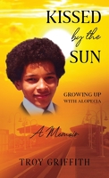 Kissed by the Sun: Growing Up with Alopecia 0578590042 Book Cover