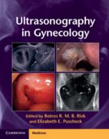 Ultrasonography in Gynecology 1107029740 Book Cover