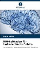 MRI-Leitfaden für hydrozephales Gehirn: Ein Leitfaden zur gestörten Hydromechanik des Gehirns 6204159399 Book Cover