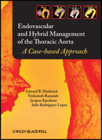 Endovascular And Hybrid Management Of The Thoracic Aorta: A Case Based Approach 1405175354 Book Cover
