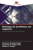 Moulage de prothèses sur implants (French Edition) 6207745973 Book Cover