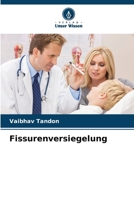 Fissurenversiegelung (German Edition) 6209047394 Book Cover