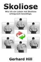 Skoliose: Wie ich ein Leben mit Skoliose erfolgreich bew�ltige 1008965456 Book Cover