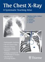 The Chest X-Ray: A Systematic Teaching Atlas 1588905543 Book Cover