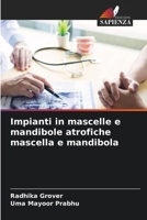 Impianti in mascelle e mandibole atrofiche mascella e mandibola (Italian Edition) 6208351316 Book Cover