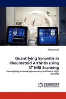 Quantifying Synovitis in Rheumatoid Arthritis using 3T MRI Scanning 3838387996 Book Cover