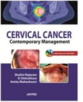 Cervical Cancer: Contemporary Management 9350255820 Book Cover