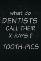 What do dentist call there x-rays? Tooth-pics: Funny dentist notebook about x-rays 1712929984 Book Cover