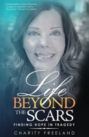Life Beyond the Scars: Finding Hope in Tragedy 1647468647 Book Cover