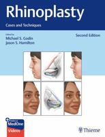 Rhinoplasty: Cases and Techniques 1604066806 Book Cover